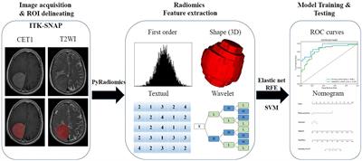 Three-Dimensional Radiomics Features From Multi-Parameter MRI Combined With Clinical Characteristics Predict Postoperative Cerebral Edema Exacerbation in Patients With Meningioma